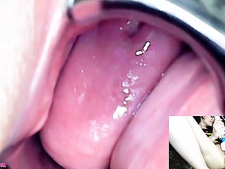 Adalynnx - منظار المنظار المضاربة Hitachi Varial Cum
