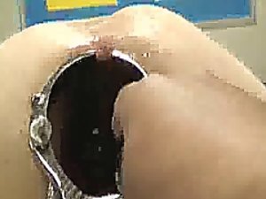 Şok Anal spekulum açılmakta ve fisting